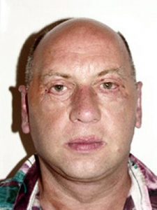 terryB_5days after surgery in Franc